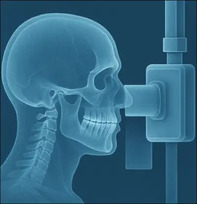 بررسی ارتباط بین بلوغ اسکلتی و مراحل تکامل دندان‌های نیش و مولر دوم در جمعیت ایرانی
